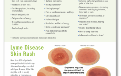 Όλα όσα πρέπει να γνωρίζετε για τη Νόσο Lyme