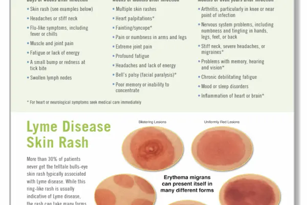 Όλα όσα πρέπει να γνωρίζετε για τη Νόσο Lyme image 1