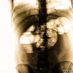 ειλεόσ — GR news