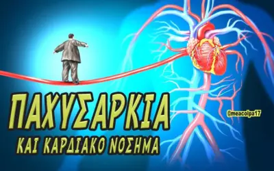 παχυσαρκία — GR news